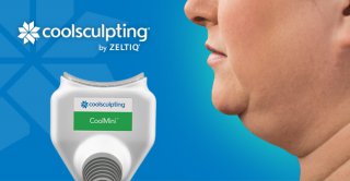 Atténuer le double menton Coolsculpting Mini (CoolMini) à Béziers