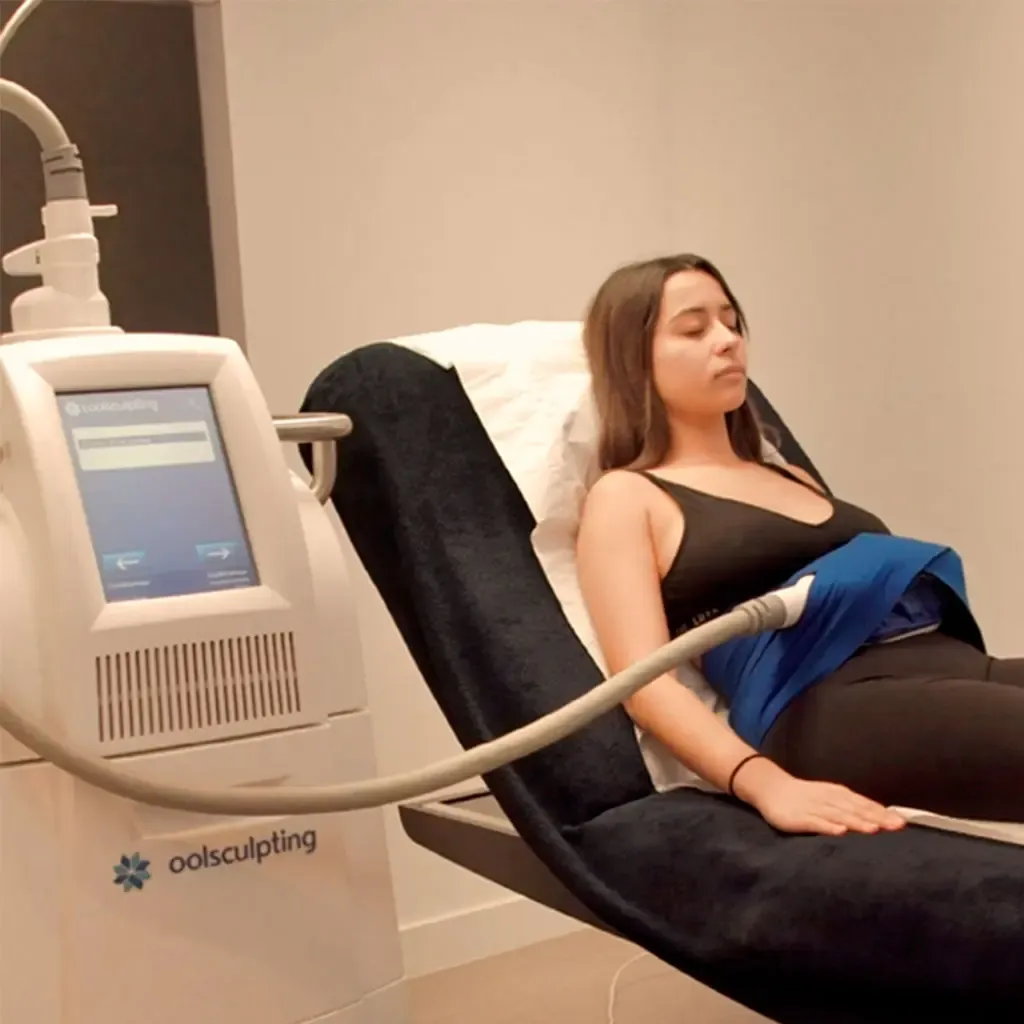Cryolipolyse par Coolsculpting à Béziers