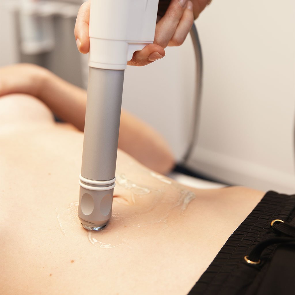 Ondes de Choc à Béziers | Remodelage Silhouette, Cellulite, Vergetures