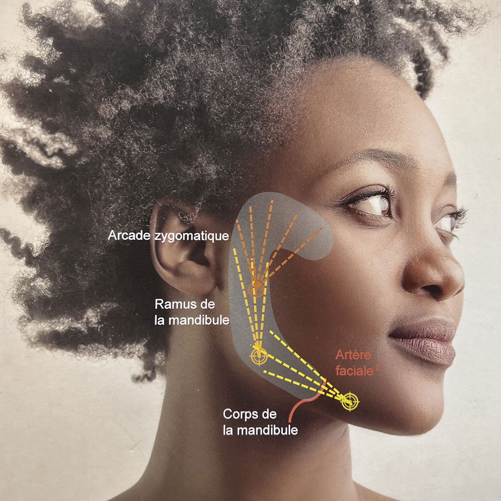 MD Codes à Béziers | Injections Acide Hyaluronique Anti-Âge